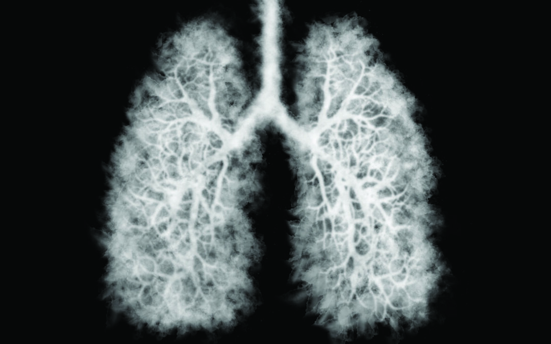 Illustration of a toxic smoke in Lung